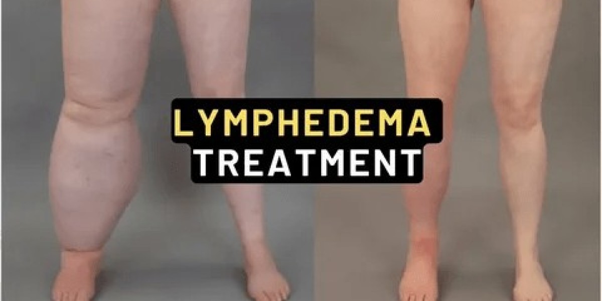 Global Secondary Lymphedema Treatment Market Overview