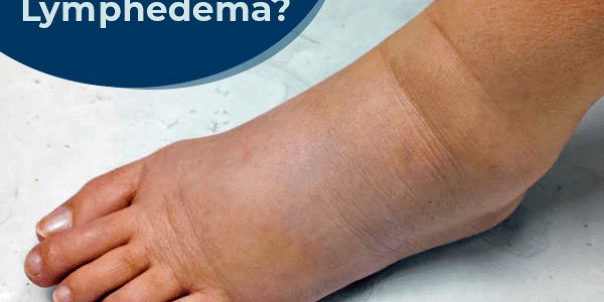 Global Lymphedema Drugs Market Size & Forecast