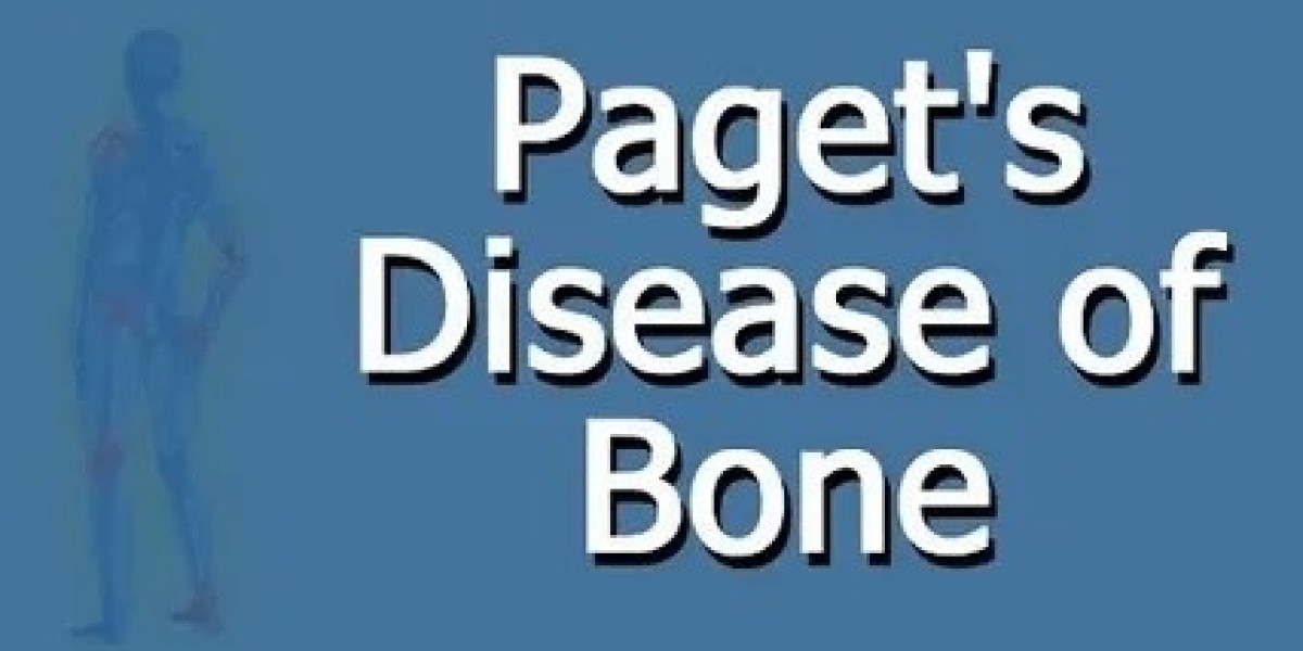Global Paget’s Disease Treatment Market Overview