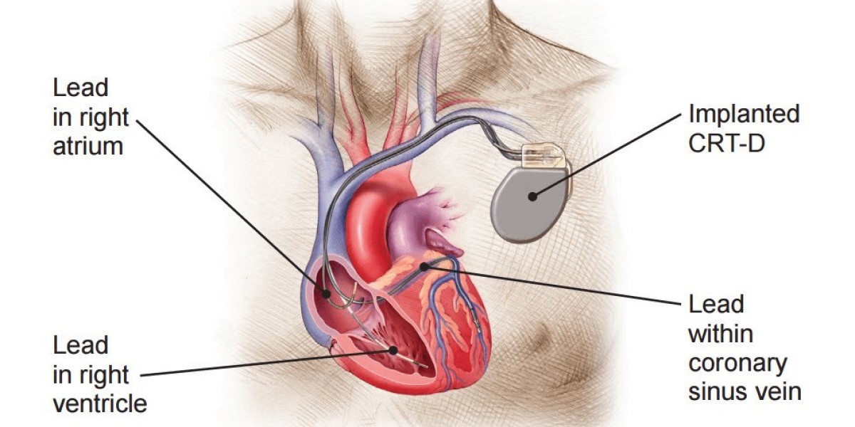 Cardiac Bio Implant Devices Market Size & Forecast