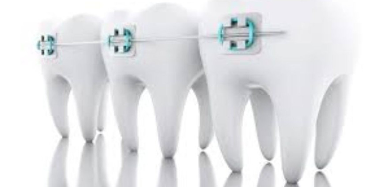 Social Media Content Ideas for Orthodontists That Drive Patient Engagement