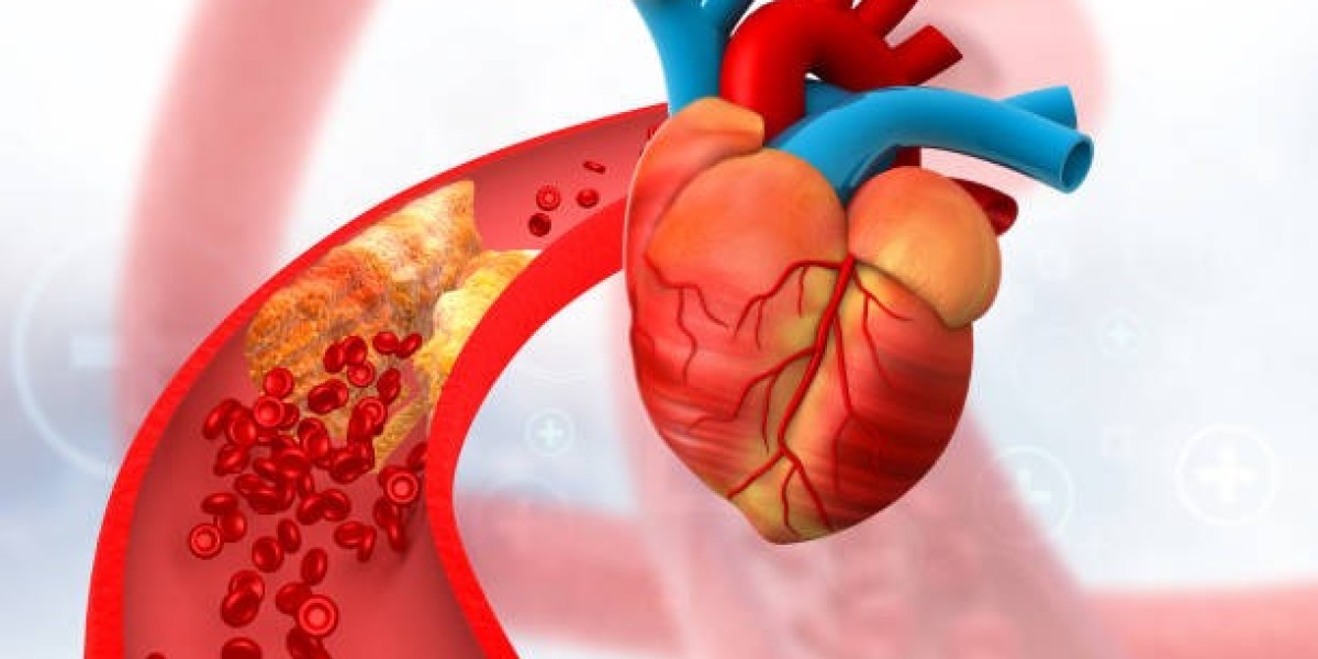 Genetic Risk of Heart Disease and Preventive Cardiology at Terna Speciality Hospital