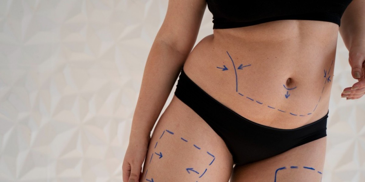 Combining Liposuction in Dubai with Other Cosmetic Procedures