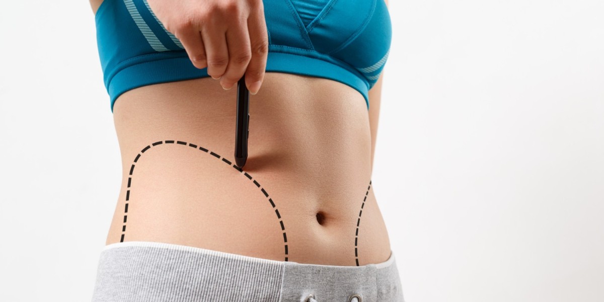 Why Vaser Liposuction in Dubai Is a Popular Choice for Body Sculpting