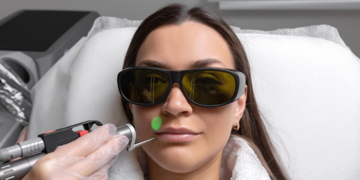 Deep Resurfacing With CO2 Laser in Manchester