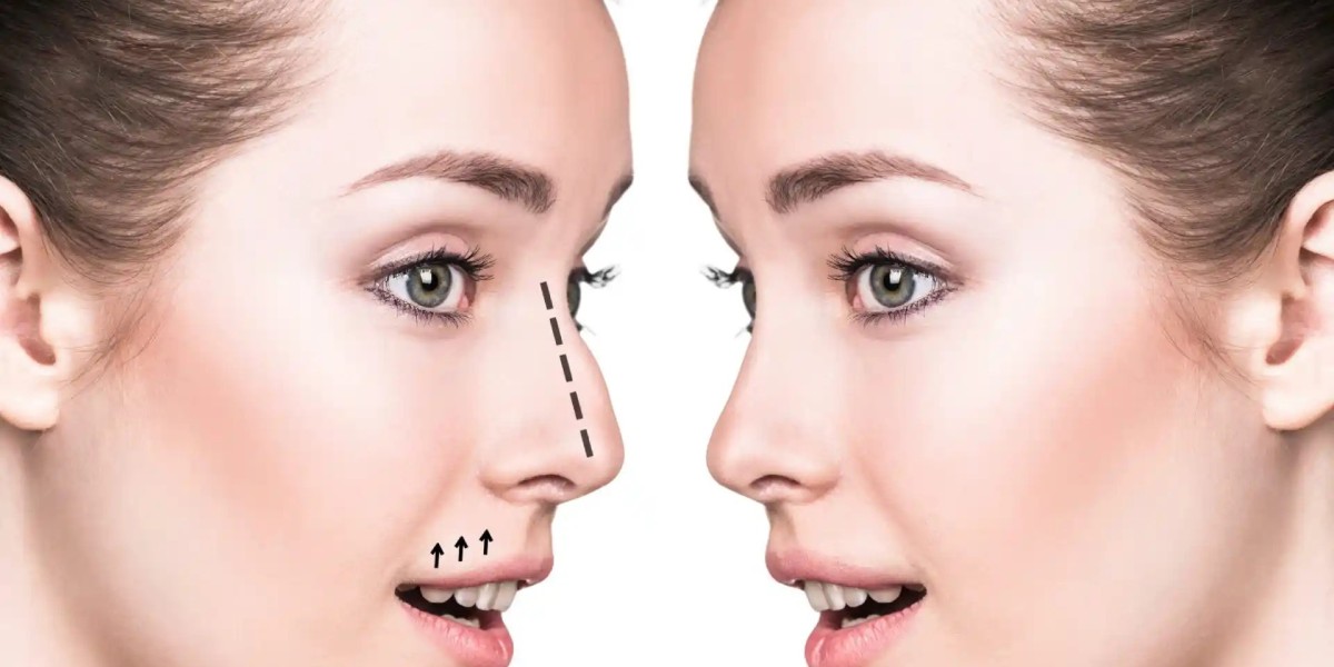 How Do Best Rhinoplasty Surgeons in Dubai Correct Nasal Issues?