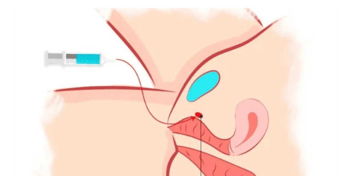 G-spot Enhancement in Dubai: How It Can Improve Confidence and Intimacy