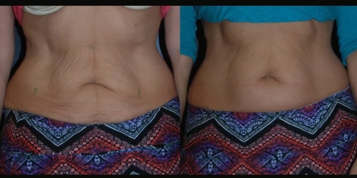 Best Plastic Surgeons in Dubai Trusted for Professional Skin Tightening