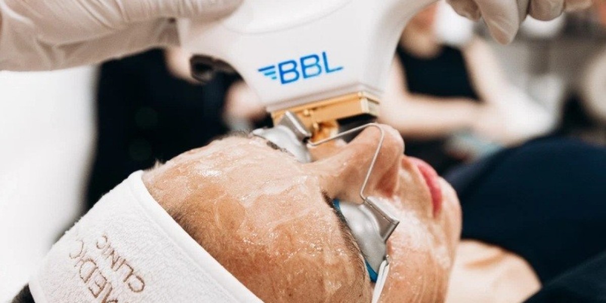 Why Manchester Residents Prefer BBL Laser