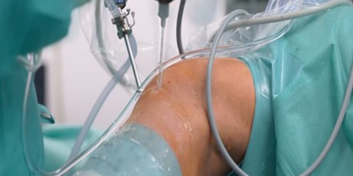 Best Joint Care with Arthroscopic Surgery at Terna Hospital Navi Mumbai