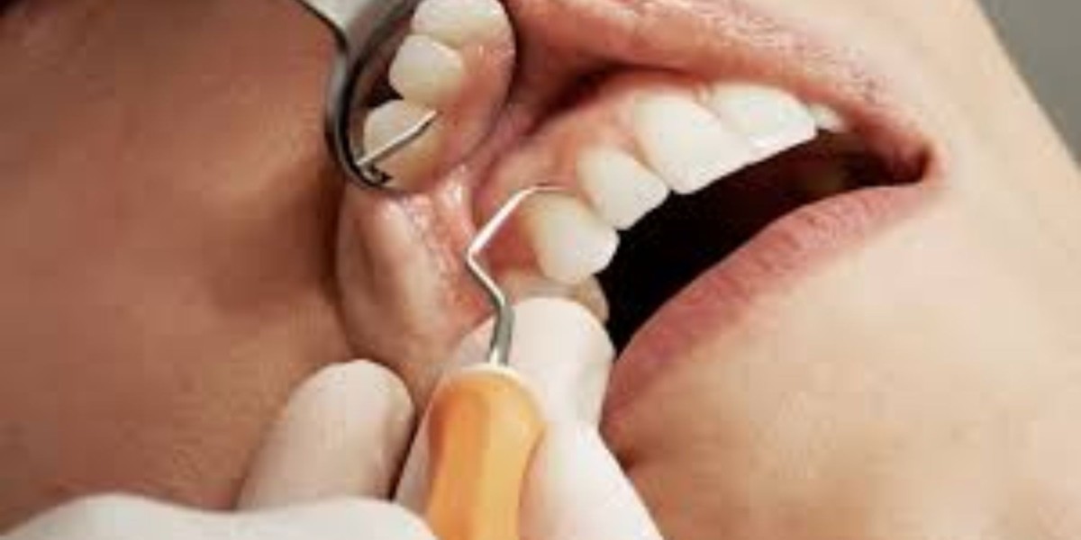 Implant Dentistry Chicago: Advanced Solutions for Permanent Tooth Replacement