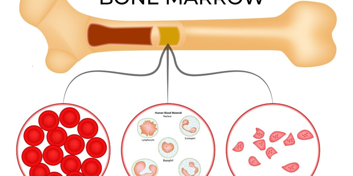 How Stem Cell Therapy for Bone Marrow in Dallas Supports Joint Recovery