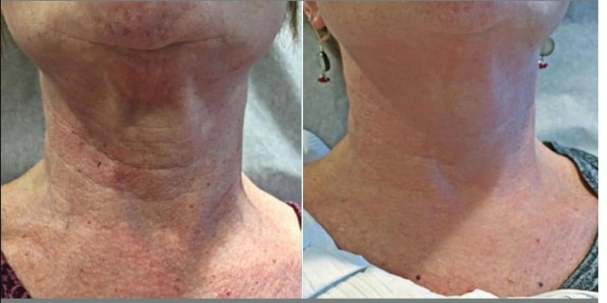 Best Plastic Surgeon in Dubai for Customized Skin Rejuvenation Programs