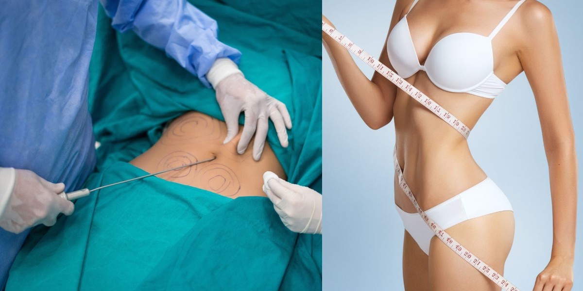 احصل على خصر منحوت اليوم في دبي