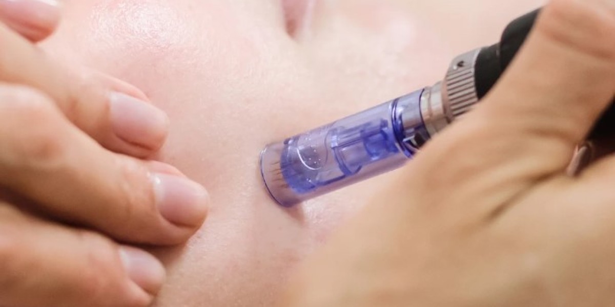 Microneedling in Manchester: Boost Collagen for Smoother, Healthier Skin