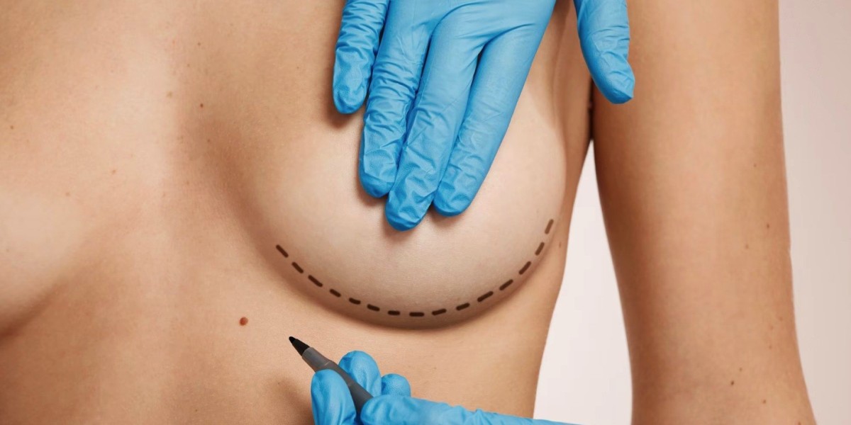Breast Lift in Dubai: What Influences the Cost the Most?