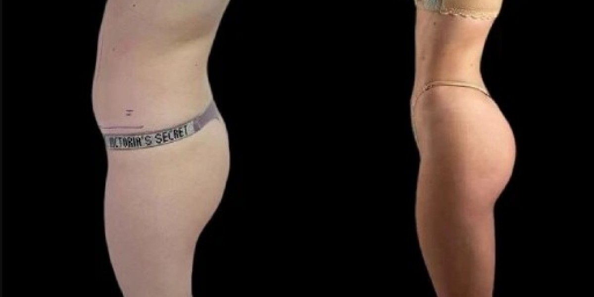 Why the Best Plastic Surgeon in Dubai Is Preferred for J-Plasma