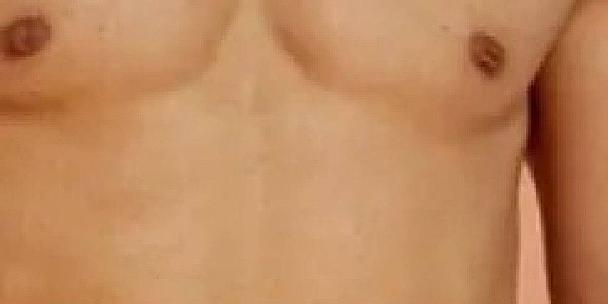 أهم فوائد شفط الدهون في جدة لتحسين شكل الجسم بسرعة