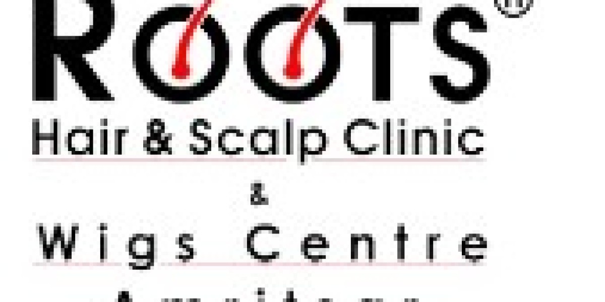Hair Topper for females in amritsar--Roots Hair & Scalp Clinic