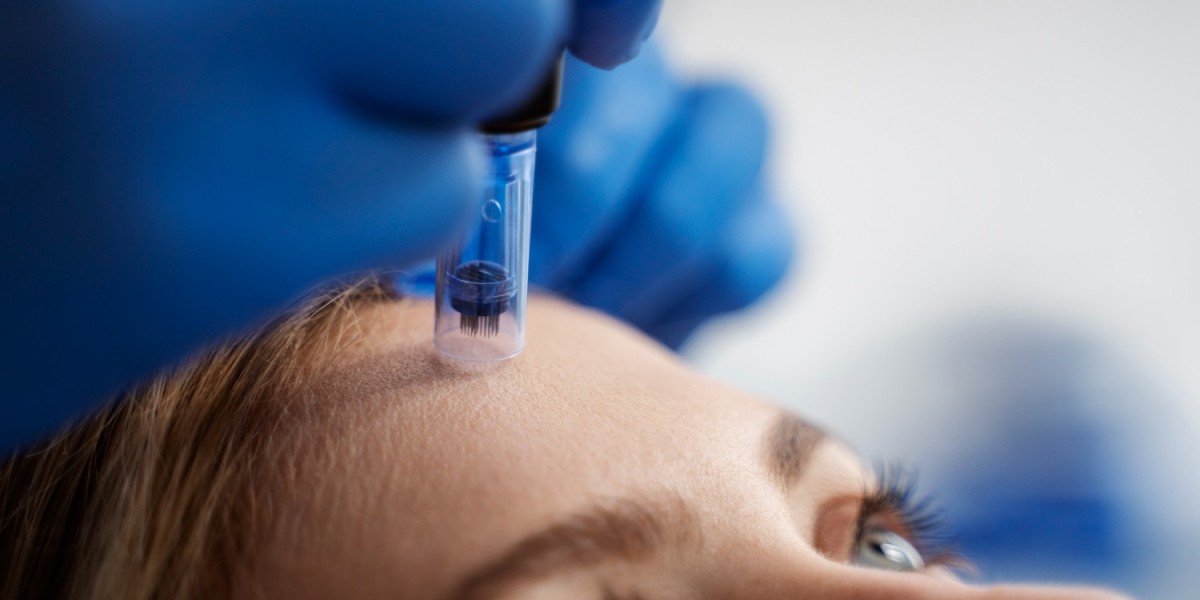 Skinpen Microneedling in Altrincham: Everything You Need to Know Before Starting