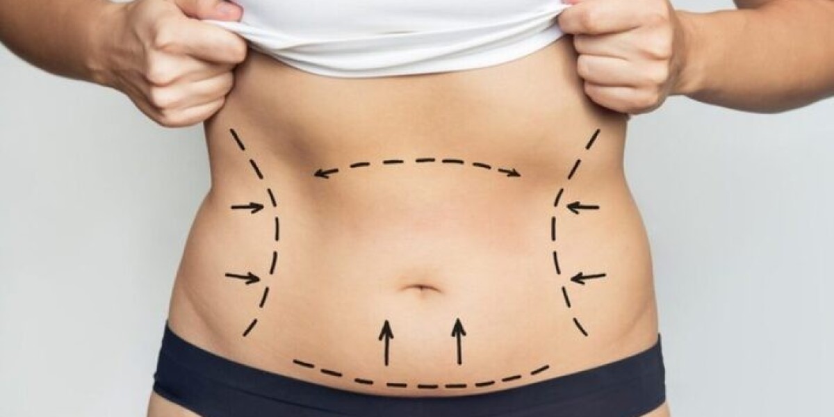 Confidence Starts Here with Best Doctors in Dubai Liposuction Treatments