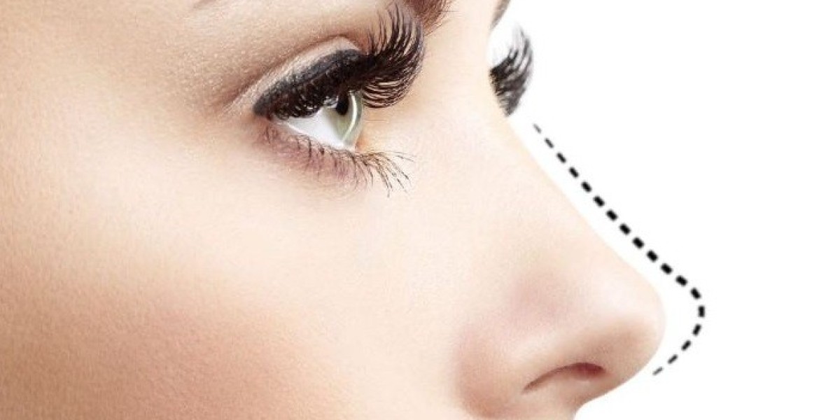 هل تبحثين عن تجميل الأنف في دبي؟ دليل شامل للمبتدئين