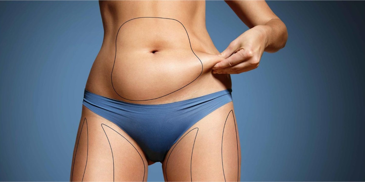 Abdominoplasty Dubai: A Complete Guide to Tummy Contouring Surgery